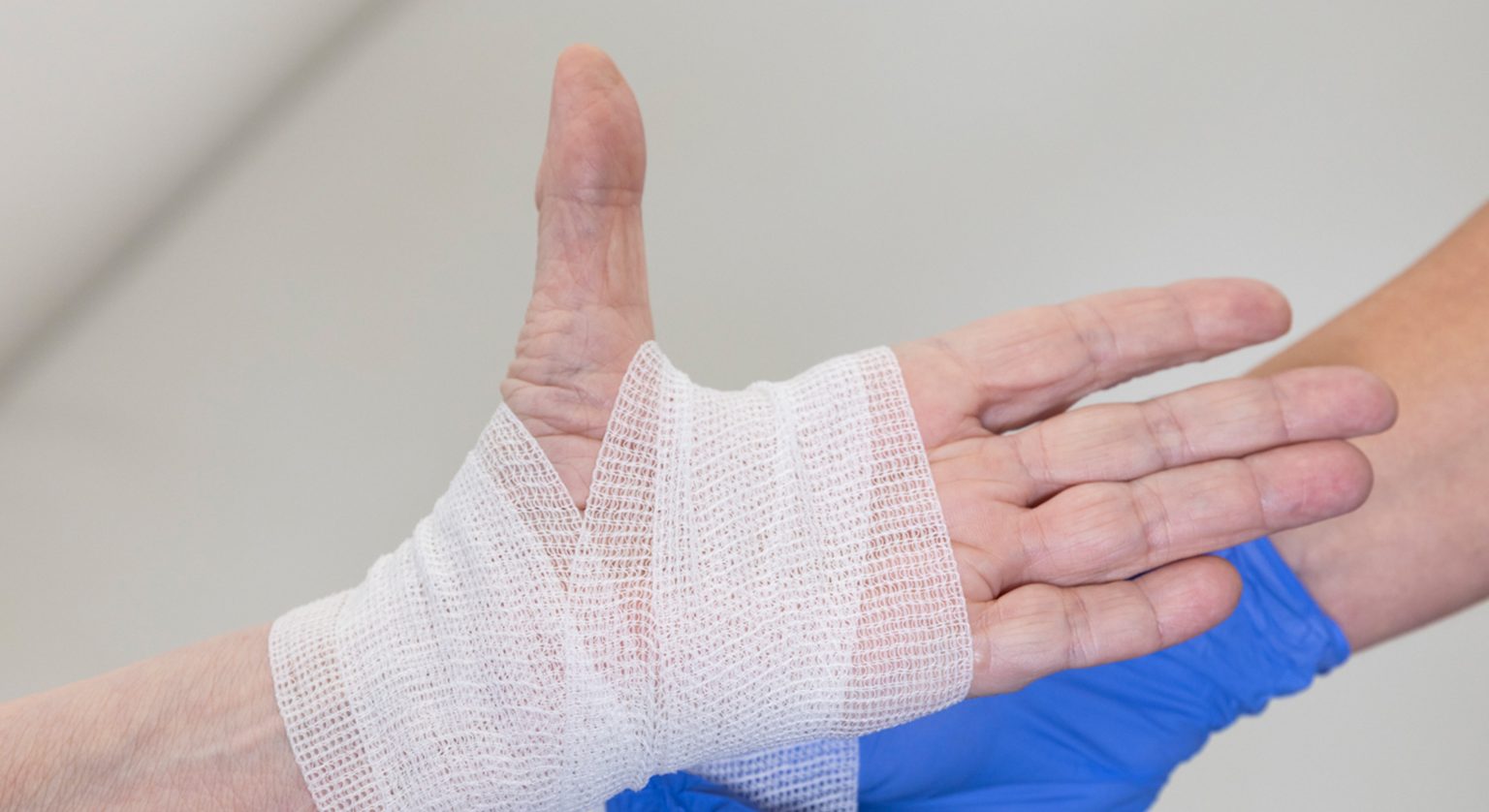 Tendovaginitis stenosans de Quervain, Die Handchirurgie